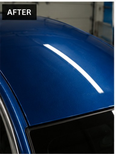 After PDR repair