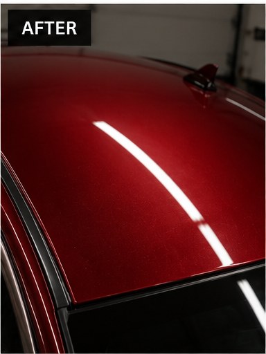 After PDR repair